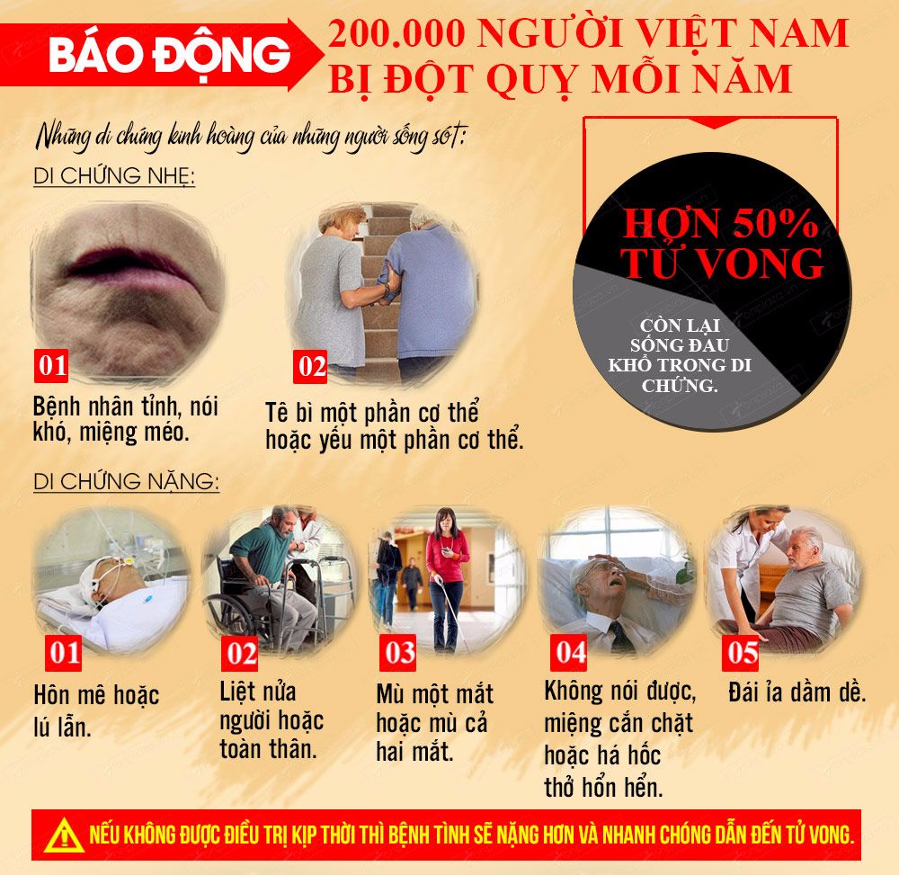 Con số báo động về số người bị đột quỵ ở Việt Nam mỗi năm